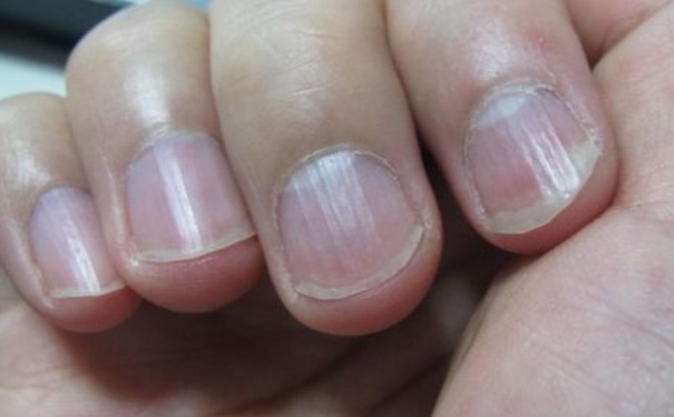 如何对身体状况进行自查？怎样知道自己的身体状况？[图]