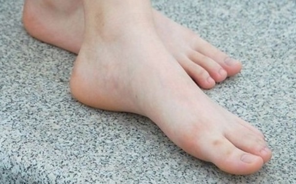 如何从脚看健康？怎样从脚看身体健康状况？(1)