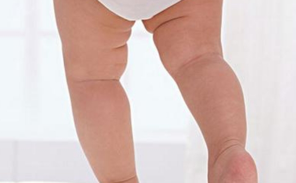婴儿O型腿如何判断？婴儿O型腿怎么辨别？(1)