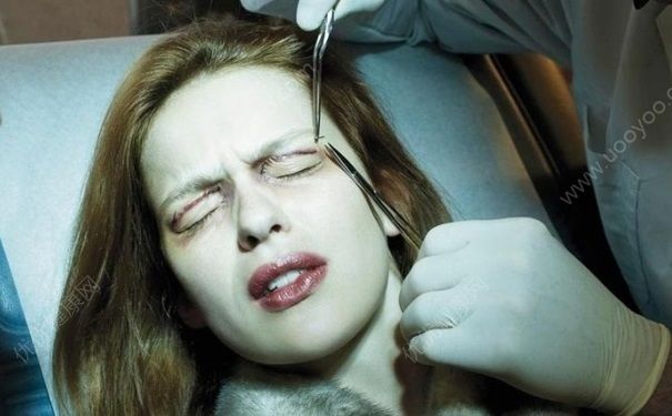 17岁女生整形好不好？男生能接受女生整容吗？(4)