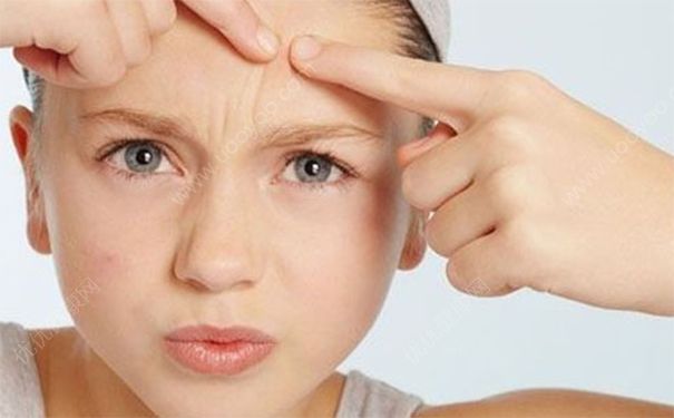 青春期长痘几岁结束？青春期长痘痘会持续多久？(3)