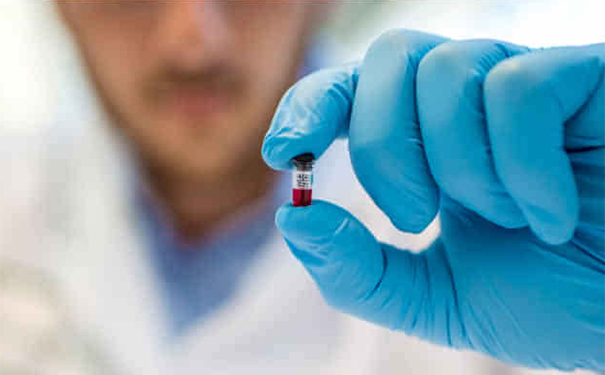 血红蛋白正常值是多少？血红蛋白正常值范围(1)