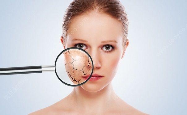 冬季皮肤起皮怎么办？冬季皮肤缺水怎么缓解？(1)