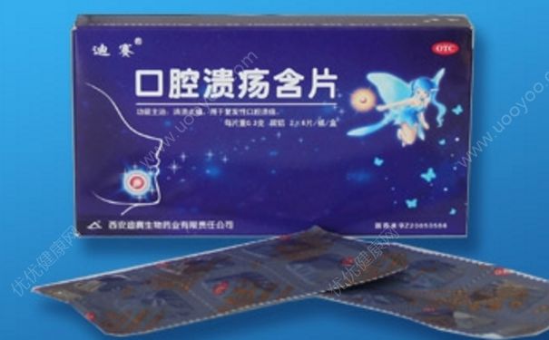 口腔溃疡含片怎么用？口腔溃疡含片多少钱？(1)