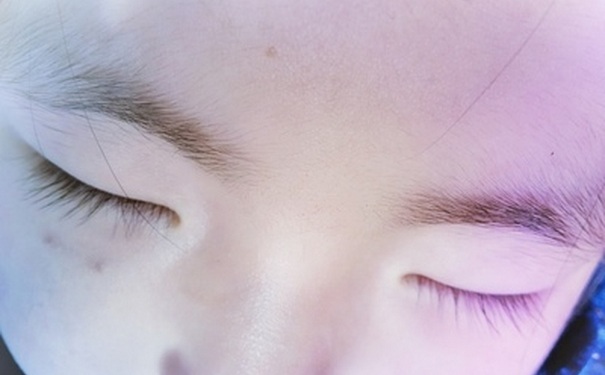 宝宝睫毛倒长怎么办？婴儿倒睫毛怎么办？(1)