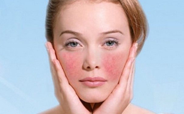 脸部过敏发红怎么办？脸部过敏很痒怎么办？(1)