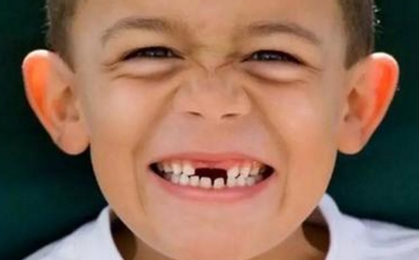 孩子换牙期要注意什么？孩子换牙的时候有什么要注意的地方？(1)