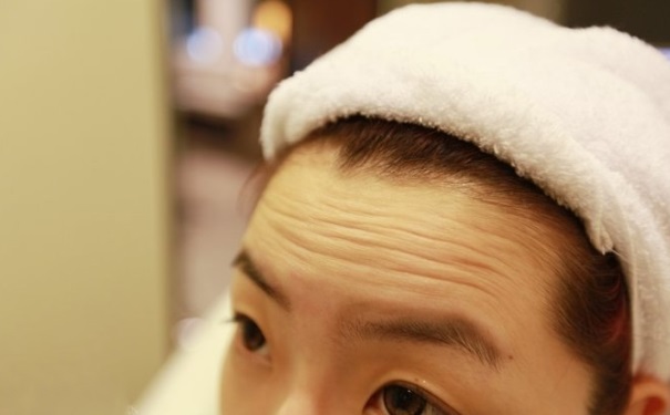 如何有效去除额头皱纹？额头有皱纹怎么有效去除？(1)