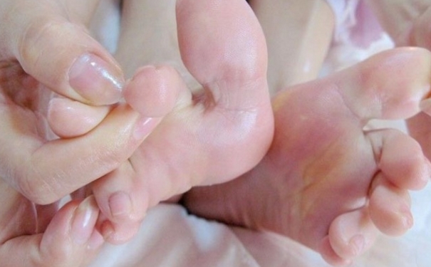 什么是脚气有哪些症状？脚气是什么样的？[图]