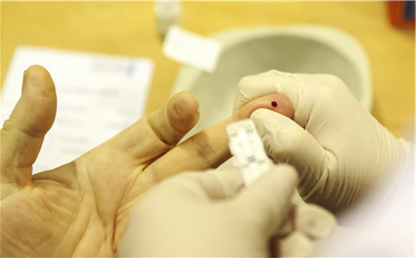 肝功能检查的时候发现丙氨酸氨基转移酶偏高是怎么回