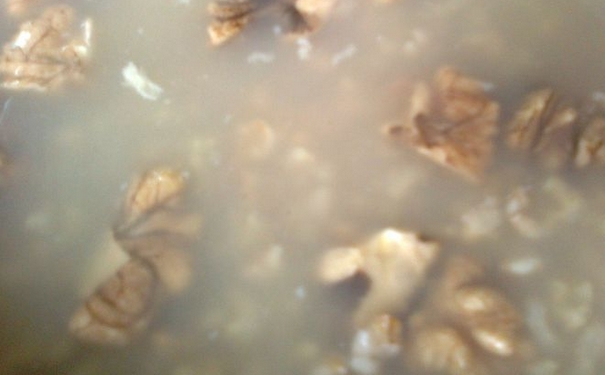 痛风吃什么食物好？缓解痛风的药膳有哪些？[图]