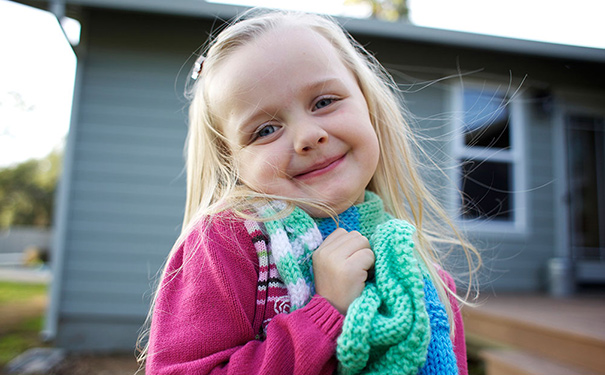为什么皮肤有很多的鸡皮疙瘩？怎么样去除皮肤上的鸡皮