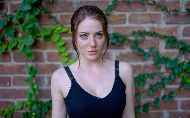 疱疹的治疗方法有哪些？皮肤上面有疱疹该怎么办？[图]