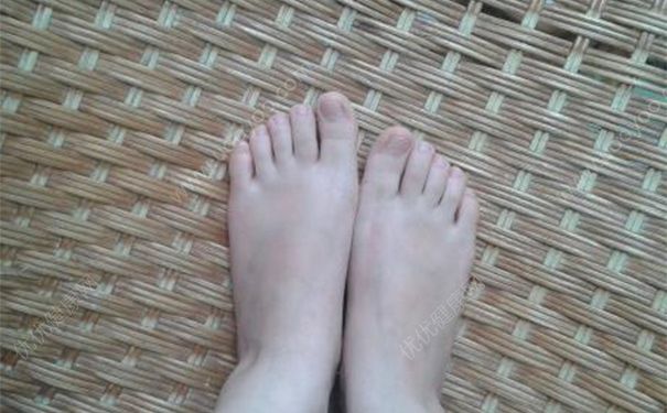 脚指甲长到肉里面该怎么办？脚指甲长肉里处理方法有哪