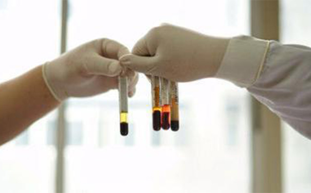 什么是微循环？微循环障碍产生的原因有哪些？[图]