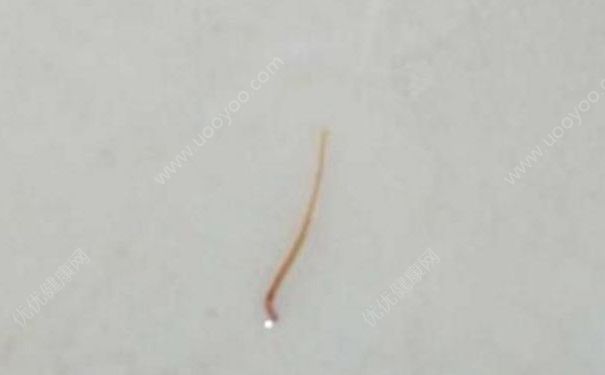 女子洗澡时花洒冲出虫子是什么原因？虫子是怎么跑到花