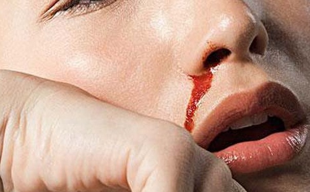 流鼻血为什么会咳血痰？流鼻血咳血怎么回事？[图]