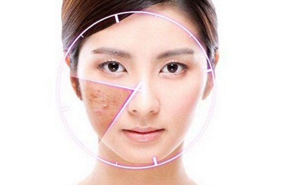 丘疹性痤疮怎么治？丘疹性痤疮怎么治疗？[图]