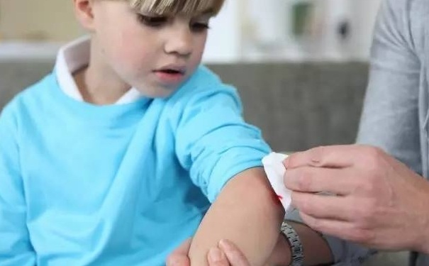 被狗咬破了一点皮有事吗？被狗咬出血不打针行吗？[图]