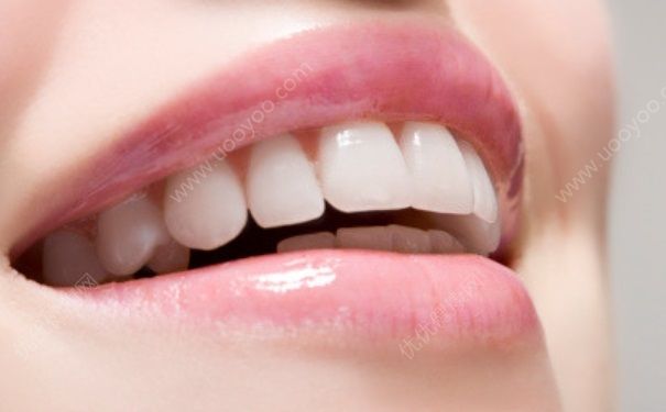 牙结石用什么漱口水？牙结石用什么漱口水好？(1)