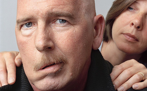 黄鳝血能治疗面瘫吗？如何用黄鳝血治疗面瘫？[图]