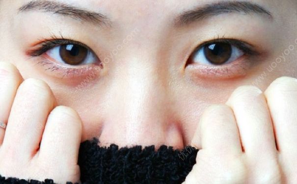 清晨黑眼圈重怎么办？早上起床黑眼圈重怎么办？(1)