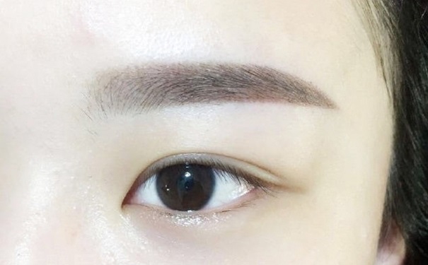 眉毛上有疤怎么办？祛疤的方法有哪些呢？(1)