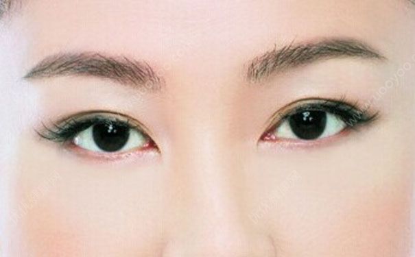 强生美瞳怎么样？强生美瞳佩戴注意事项(1)