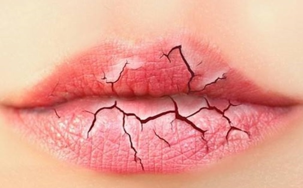 嘴唇蜕皮是怎么回事？嘴唇蜕皮是什么原因？(1)