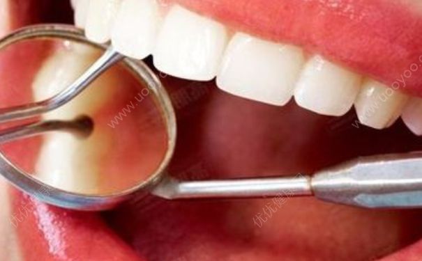 洗牙对牙齿有伤害吗？洗牙能让牙齿变白吗？[多图]