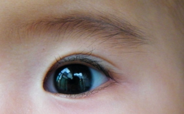 干眼症热敷好还是冷敷好？干眼症冷敷还是热敷？(1)