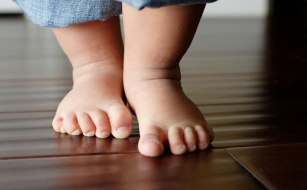 孩子为什么会扁平足？宝宝扁平足应该怎么治疗？(1)