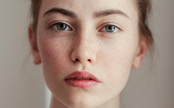 眼睛下面长斑是怎么原因？眼睛周围长斑咋回事？(1)