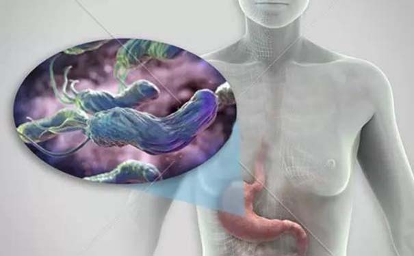 幽门螺杆菌会传染吗？幽门螺杆菌怎么检查？[图]