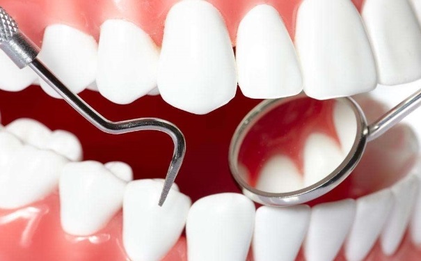 洗牙对牙齿好不好？洗牙的误区[图]