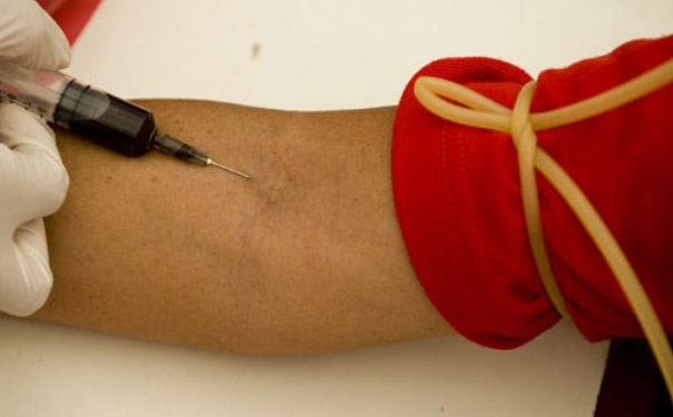 抽血对身体有影响吗？抽血对身体有好处吗？[图]