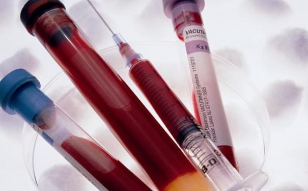 脑供血不足可以献血吗？脑供血不足献血好吗？[图]