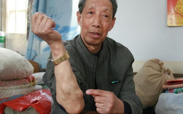 脂肪瘤疼痛是怎么回事？脂肪瘤痛是怎么回事？(1)
