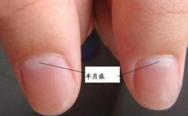 指甲半月痕代表什么？从指甲半月痕看生育能力(1)
