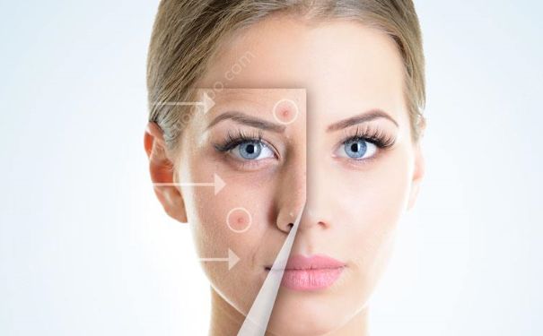 春季敏感肌用什么护肤品？春季敏感肌用什么护肤品好？(1)