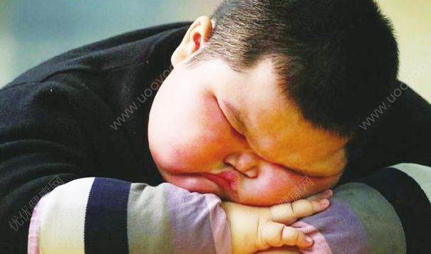 引起儿童肥胖的原因是什么？儿童肥胖该怎么减？(1)