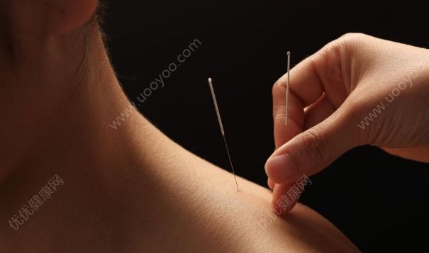 针灸减肥的误区有哪些？如何避免针灸减肥的不利影响？(1)