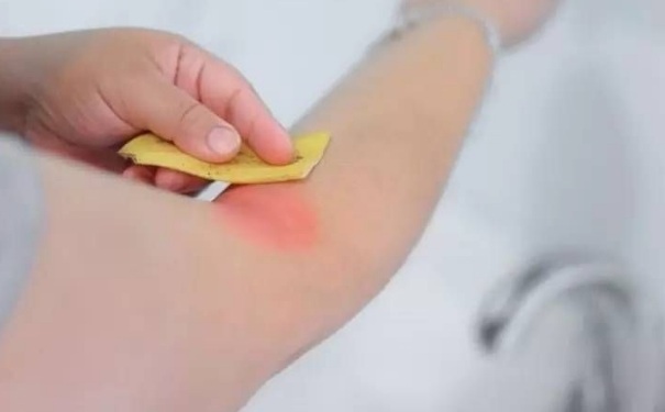 香蕉皮煮水可以止痒吗？香蕉皮能止痒吗？(1)