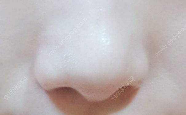 黑头贴怎么撕下来？黑头贴的正确撕法是怎样？(1)