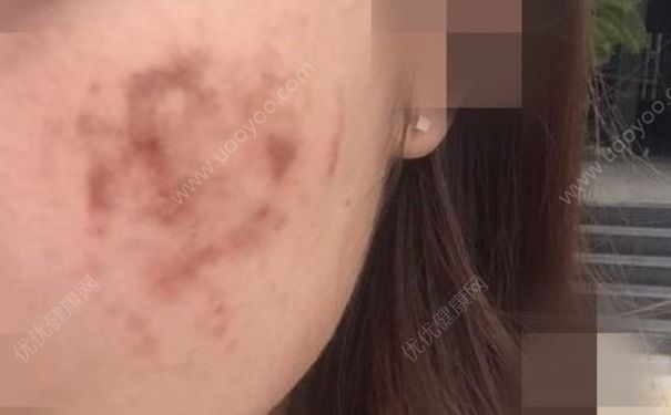 伪劣化妆品让多名大学生惨遭毁容，怎么分辨伪劣化妆品？(2)