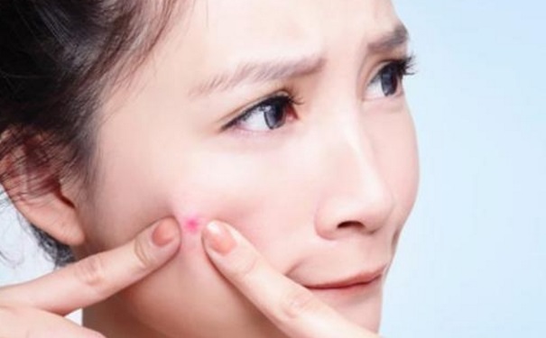 什么是闭口痘痘？如何有效去除闭口痘痘？(1)