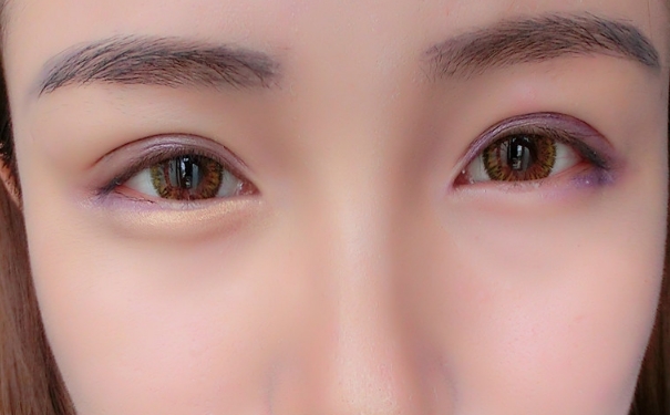 卧蚕是天生的吗？卧蚕眼是天然就有的吗？(1)