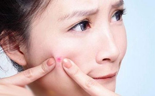 脸上的痘痘是怎样形成的？让痘痘不在纠缠我们(1)