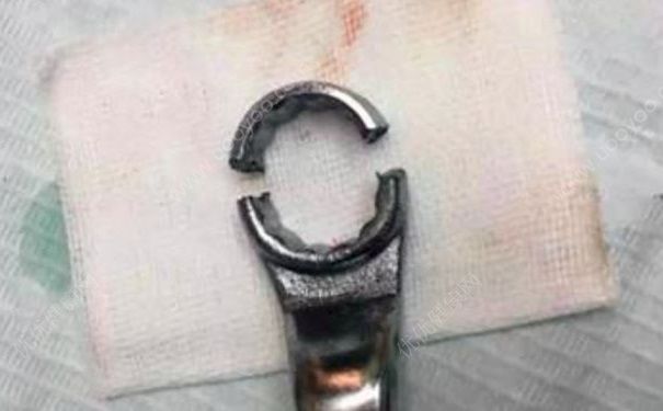 男子下体被扳手套住17小时，男性的这些自慰方法好危险