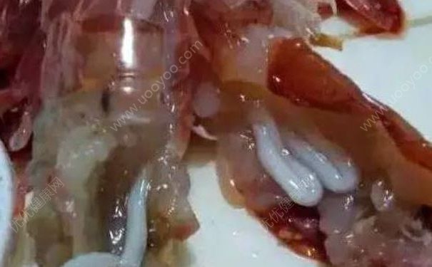 对虾体内有白色寄生虫，虾子里面长寄生虫是真的吗？(2)